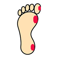 足と靴と健康の豆知識　タコとウオノメできにくくするには